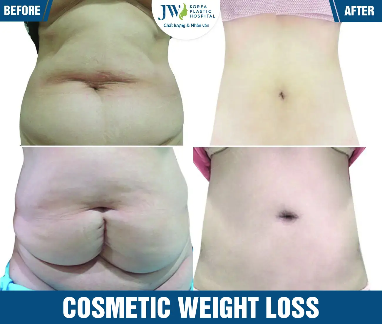 Cosmetic weight loss